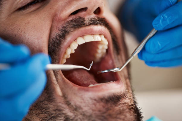 Best Emergency Dental Care for Abscessed Tooth in Ridgeville, SC