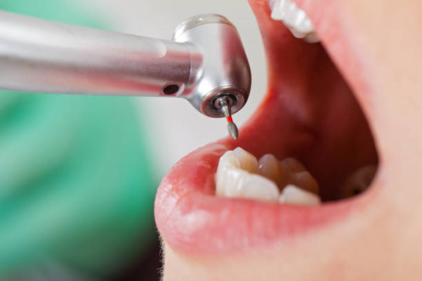 Best Broken or Cracked Tooth Emergency Dentist in Ridgeville, SC